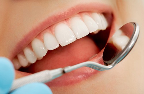 Tổng hợp thông tin bọc răng hàm từ A đến Z 3