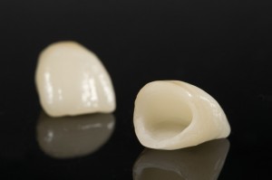 dental-crowns-1024x682