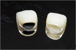 Địa chỉ nào bọc răng sứ giá rẻ nhất tại Hà Nội? 1