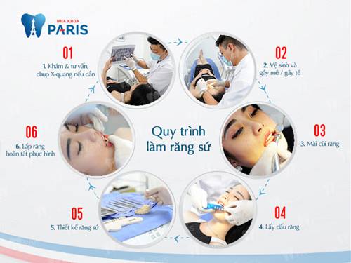 có nên bọc sứ cho răng cửa bị mọc lệch không 23