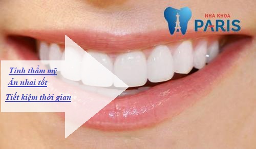 có nên bọc sứ cho răng cửa bị mọc lệch không 1