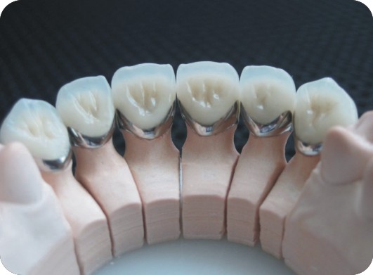 Hàn răng thưa ở đâu tốt và uy tín nhất hiện nay? 3