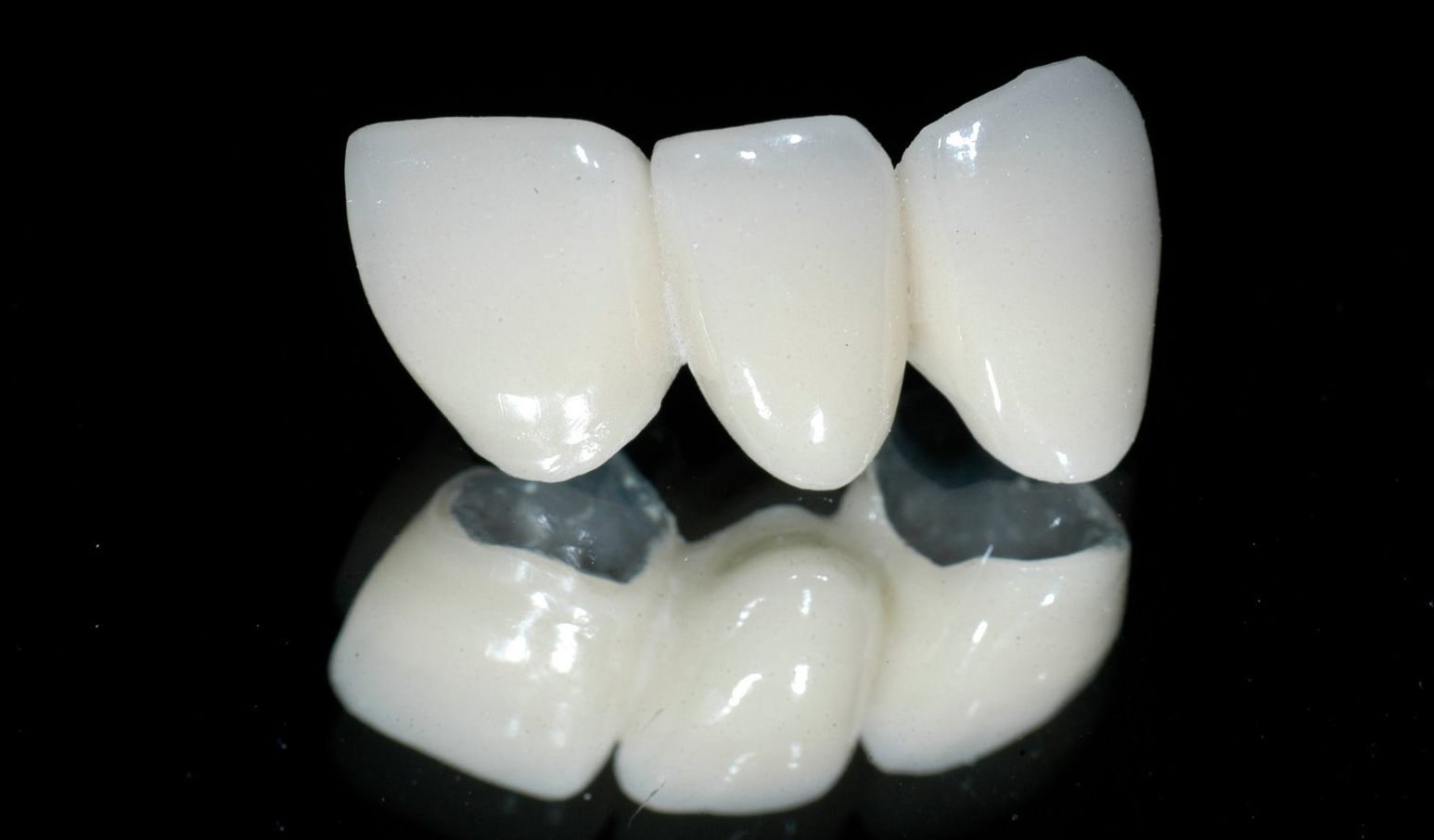 cách làm răng đều không cần niềng cách làm răng đều không cần niềng