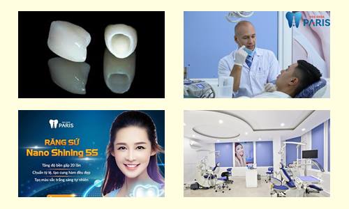 Răng sứ uống cafe có đen răng không? Bác sĩ nha khoa giải đáp 3