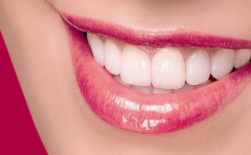Bọc răng sứ cercon bằng công nghệ CT5 chiều-Sự kết hợp HOÀN HẢO 1