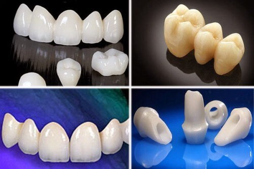 Làm mão răng là gì và tại sao nên bọc mão răng sứ? 2