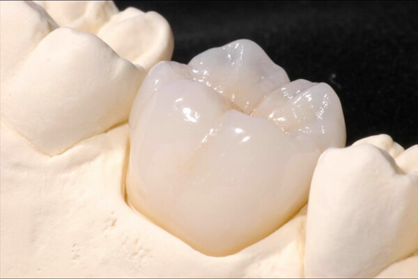 Cách làm trắng răng sứ Đơn Giản Hiệu Quả nhất cùng chuyên gia 2