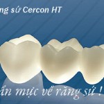 Độ bền của răng sứ Cercon là bao lâu? [Xem ngay giải đáp]