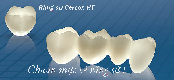 Độ bền của răng sứ Cercon là bao lâu? [Xem ngay giải đáp]