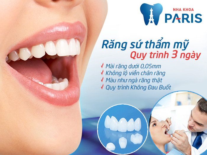 Bọc mão răng sứ – VĨNH BIỆT răng xấu cho nụ cười rạng rỡ đón TẾT