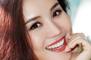 Làm răng giả mất bao lâu để hoàn tất các công đoạn?