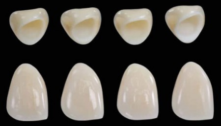 Chi tiết giá bọc 1 chiếc răng sứ là bao nhiêu?