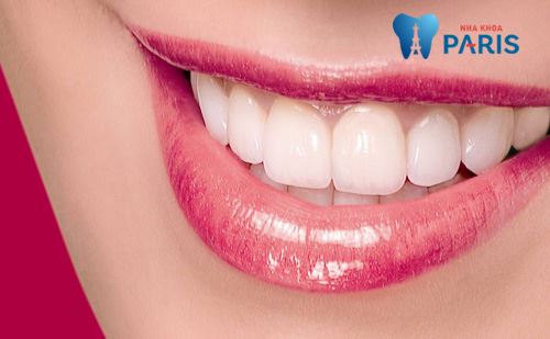 cách nhận biết răng sứ titan dựa vào đâu?