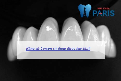 răng sứ Cercon sử dụng được bao lâu