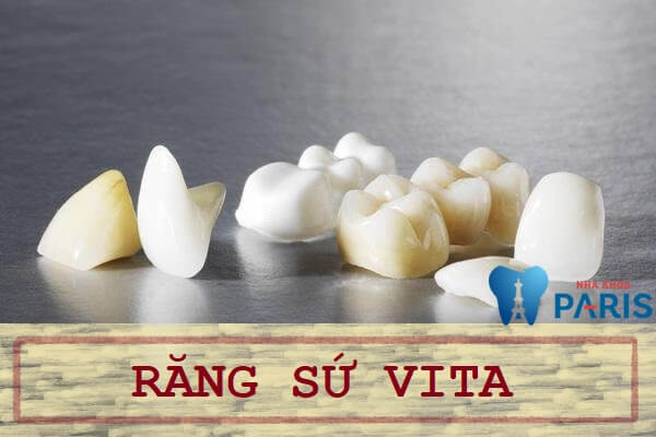 Giải đáp thắc mắc: Bọc răng sứ vita có tốt không?