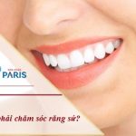 Top 5 cách chăm sóc răng sứ Cercon giúp răng khỏe đẹp trọn đời