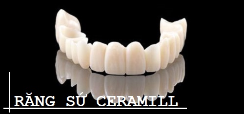Răng sứ ceramill là gì? Tìm hiểu từ A - Z về răng sứ ceramill 1