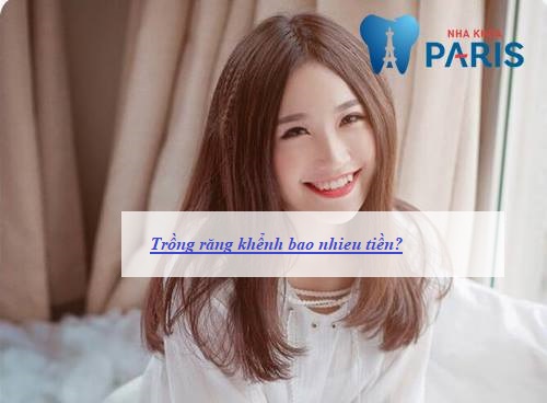 Trồng răng khểnh bao nhiêu tiền là rẻ nhất?