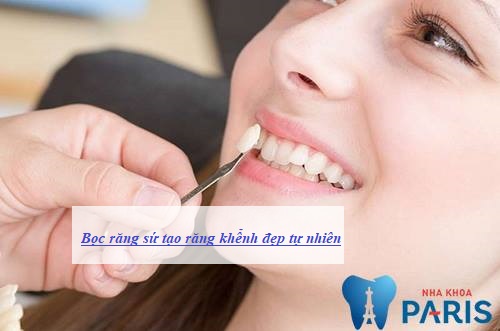 trồng răng khểnh bao nhiêu tiền là chuẩn nhất trồng răng khểnh bao nhiêu tiền là chuẩn nhất