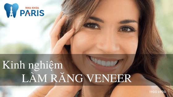 Kinh nghiệm làm răng Veneer trắng đẹp tự nhiên chuẩn Sao