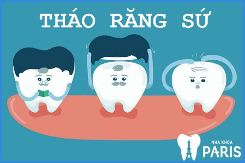 Tháo răng sứ có đau không? Quy trình tháo răng sứ ra sao?