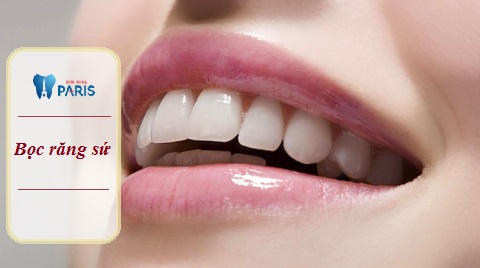 Bọc răng sứ cho răng cửa bị hô - Phương pháp thẩm mỹ răng ưu việt
